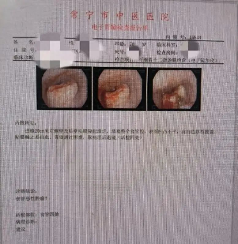 開啟腫瘤診療技術新篇！常寧市中醫(yī)醫(yī)院順利完成腫瘤患者化學治療